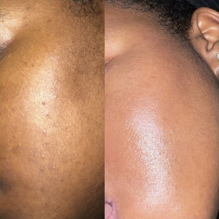 Facial Treatment Example